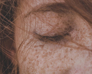 Stress et peau : quel impact et comment retrouver l’équilibre ?
